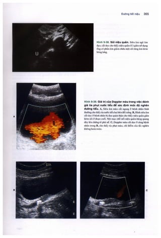 Siêu âm chẩn đoán