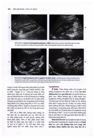 Siêu âm chẩn đoán