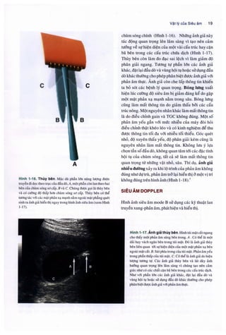 Siêu âm chẩn đoán