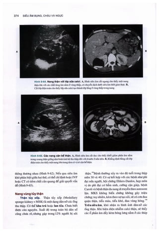 Siêu âm chẩn đoán