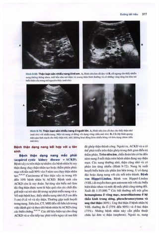 Siêu âm chẩn đoán