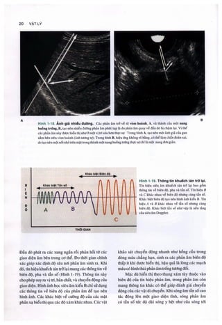 Siêu âm chẩn đoán