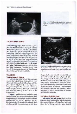 Siêu âm chẩn đoán