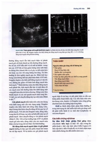 Siêu âm chẩn đoán