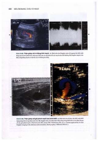 Siêu âm chẩn đoán