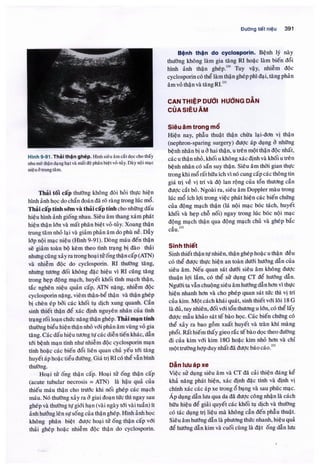 Siêu âm chẩn đoán