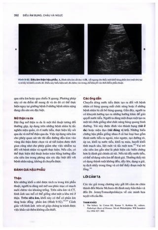 Siêu âm chẩn đoán