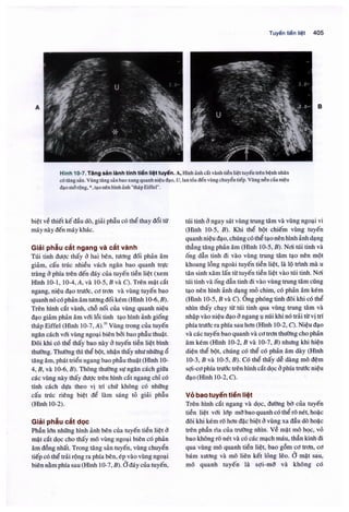 Siêu âm chẩn đoán