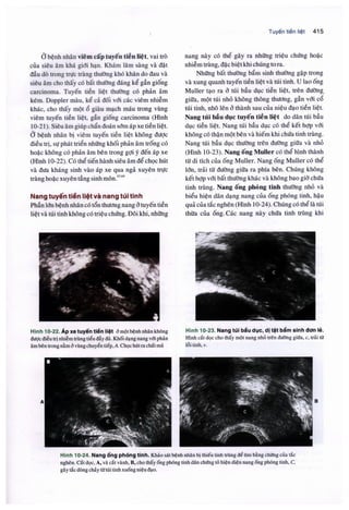 Siêu âm chẩn đoán