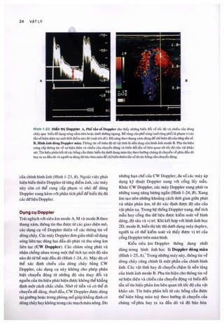 Siêu âm chẩn đoán