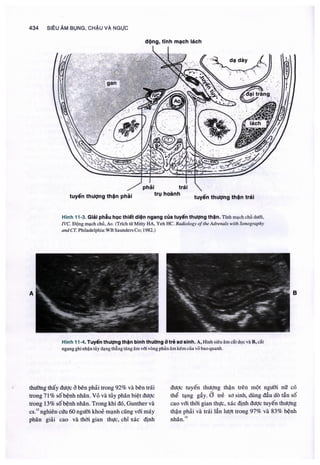 Siêu âm chẩn đoán