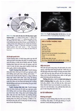 Siêu âm chẩn đoán