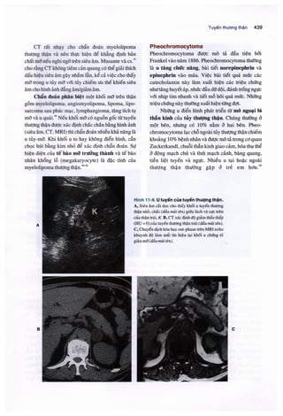 Siêu âm chẩn đoán