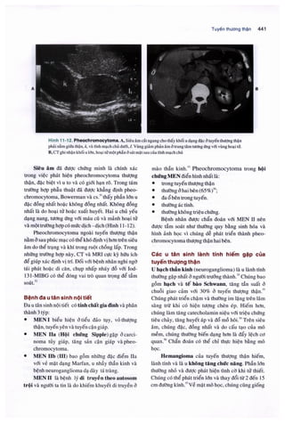 Siêu âm chẩn đoán