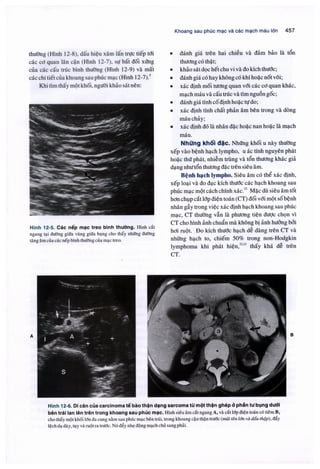 Siêu âm chẩn đoán