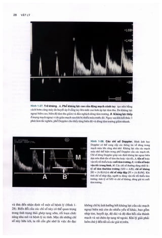 Siêu âm chẩn đoán