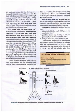 Siêu âm chẩn đoán