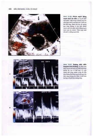 Siêu âm chẩn đoán
