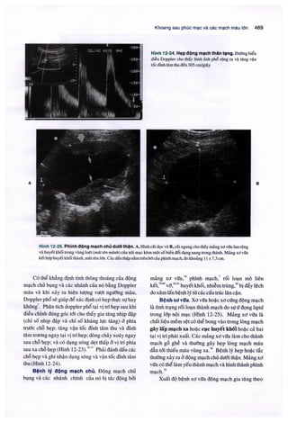 Siêu âm chẩn đoán