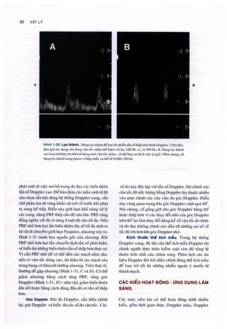 Siêu âm chẩn đoán