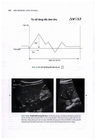 Siêu âm chẩn đoán