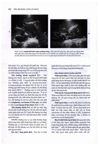 Siêu âm chẩn đoán