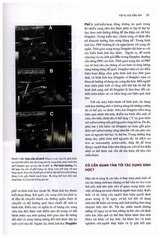 Siêu âm chẩn đoán