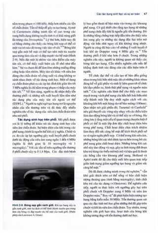 Siêu âm chẩn đoán