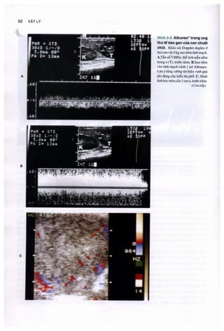 Siêu âm chẩn đoán