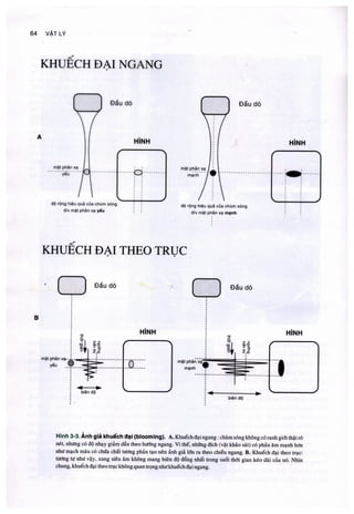 Siêu âm chẩn đoán