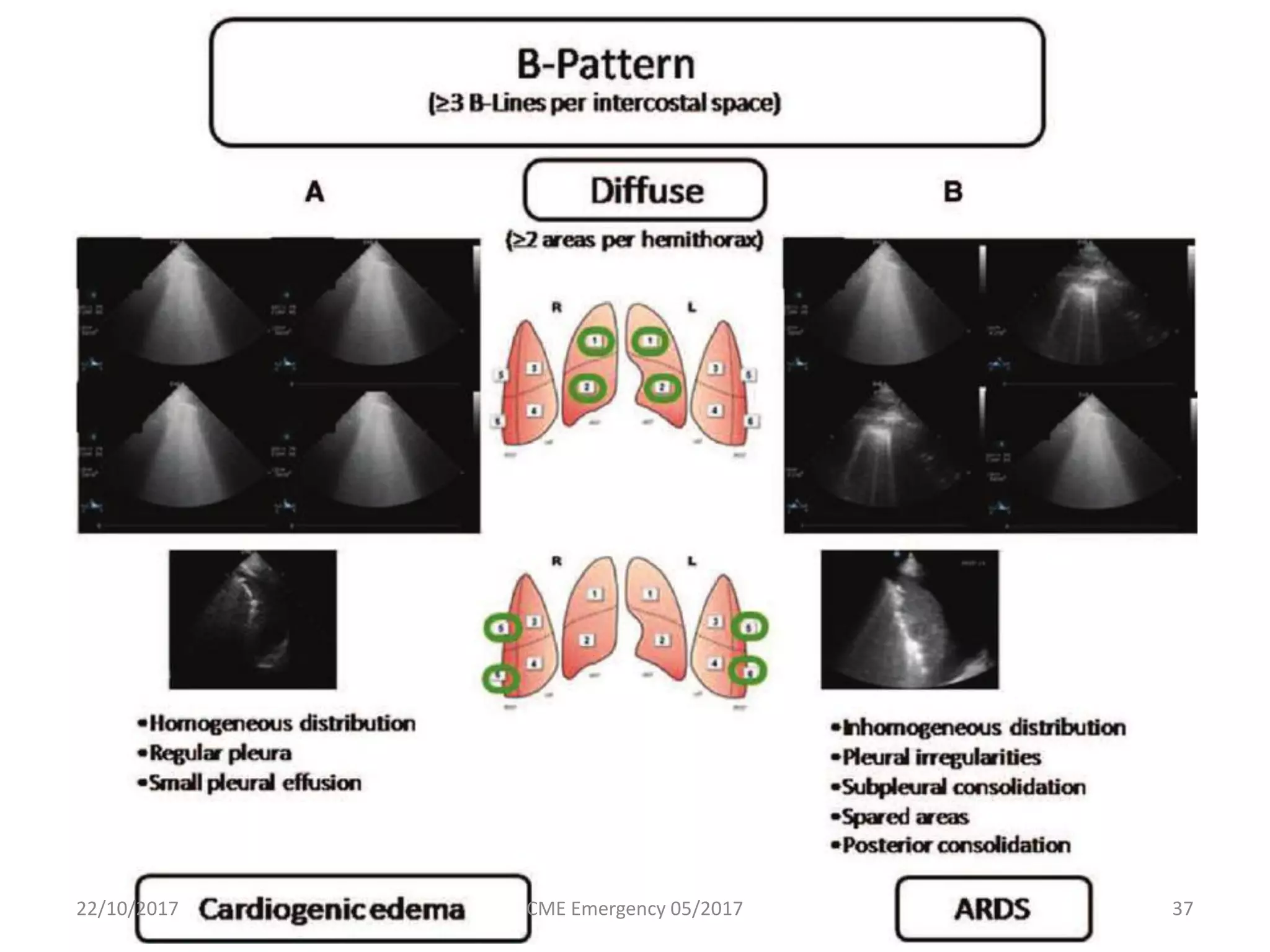 22/10/2017 CME Emergency 05/2017 37
 
