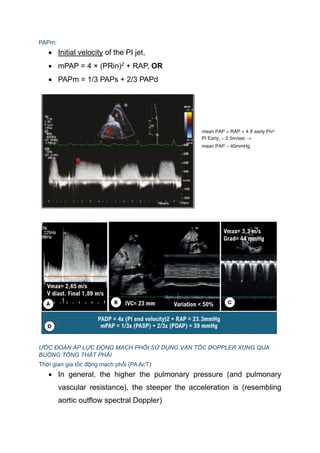 Papm Racm SIÊU ÂM TIM ĐỂ ĐÁNH GIÁ TĂNG ÁP PHỔI.pdf