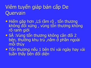 Viêm tuyến giáp bán cấp De
Quervain
• Hiếm gặp hơn ,LS rầm rộ , tổn thương
không đối xứng , vùng tổn thương không
rõ ranh giới
• SÂ :Vùng tổn thương không cân đối 2
bên, thường khu trú ,nằm ở phần ngoài
mỗi thùy
• Tổn thương nếu 1 bên thì vài ngày hay vài
tuần thấy bên đối diện
 