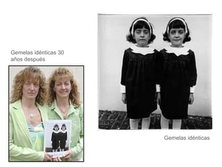 Gemelas idénticas 30 años después Gemelas idénticas 
