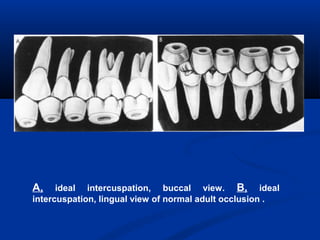 Six keys of normal occlusion - Dr. Maher Fouda | PPT