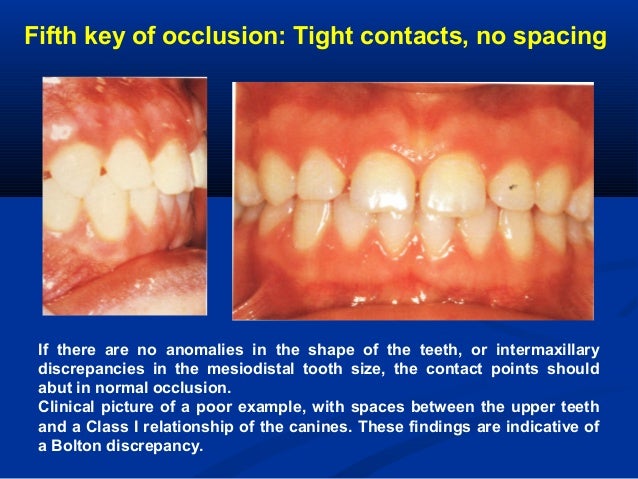 six keys of normal occlusion dr maher fouda
