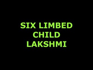 SIX LIMBED
  CHILD
 LAKSHMI
 