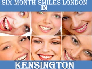 six month smiles London
 