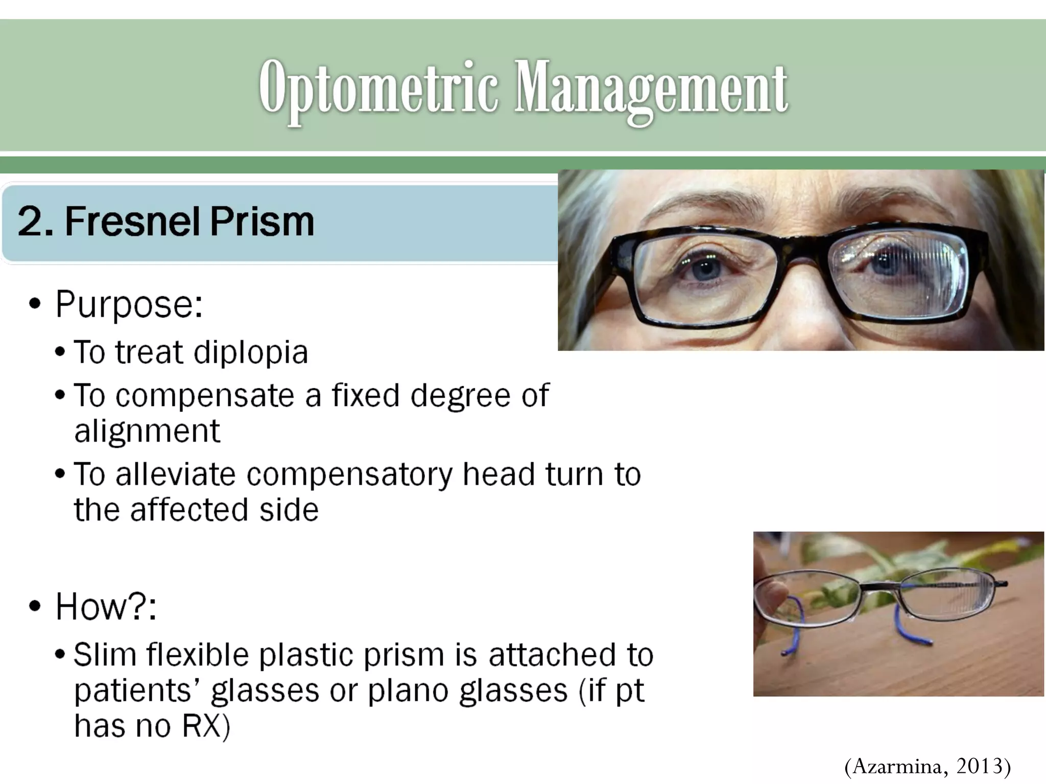 Sixth nerve palsy | PPT