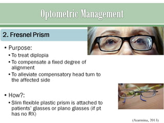 Sixth nerve palsy | PPT