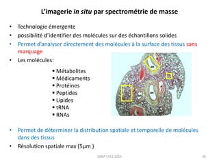 L’imagerie in situ par spectrométrie de masse
• Technologie émergente
• possibilité d’identifier des molécules sur des échantillons solides
• Permet d’analyser directement des molécules à la surface des tissus sans
marquage
• Les molécules:
 Métabolites
 Médicaments
 Protéines
 Peptides
 Lipides
 tRNA
 RNAs
• Permet de déterminer la distribution spatiale et temporelle de molécules
dans des tissus
• Résolution spatiale max (5µm )
SJBM 1412 2013

30

 