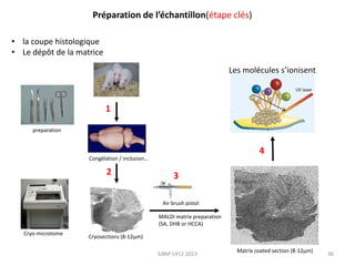 Préparation de l’échantillon(étape clés)
• la coupe histologique
• Le dépôt de la matrice
Les molécules s’ionisent

1
preparation

4

Congélation / inclusion…

2

3
Air brush pistol
MALDI matrix preparation
(SA, DHB or HCCA)

Cryo-microtome

Cryosections (8-12µm)
SJBM 1412 2013

Matrix coated section (8-12µm)

36

 
