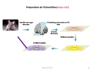 Préparation de l’échantillon(étape clés)

SJBM 1412 2013

38

 