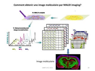 Comment obtenir une image moléculaire par MALDI imaging?

Image moléculaire
SJBM 1412 2013

39

 