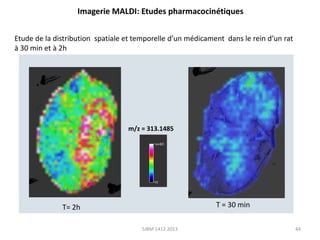 Imagerie MALDI: Etudes pharmacocinétiques
Etude de la distribution spatiale et temporelle d’un médicament dans le rein d’un rat
à 30 min et à 2h

m/z = 313.1485

T = 30 min

T= 2h
SJBM 1412 2013

44

 
