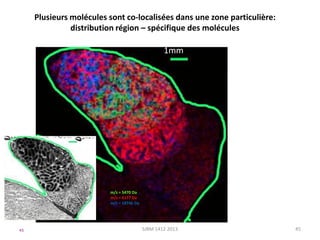 Plusieurs molécules sont co-localisées dans une zone particulière:
distribution région – spécifique des molécules

1mm

m/z = 5470 Da
m/z = 6177 Da
m/z = 18746 Da

45

SJBM 1412 2013

45

 