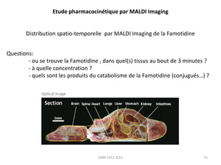Etude pharmacocinétique par MALDI Imaging
Distribution spatio-temporelle par MALDI Imaging de la Famotidine
Questions:
- ou se trouve la Famotidine , dans quel(s) tissus au bout de 3 minutes ?
- à quelle concentration ?
- quels sont les produits du catabolisme de la Famotidine (conjugués…) ?

SJBM 1412 2013

51

 
