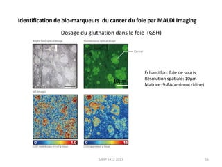 Identification de bio-marqueurs du cancer du foie par MALDI Imaging
Dosage du gluthation dans le foie (GSH)

10µm

SJBM 1412 2013

Échantillon: foie de souris
Résolution spatiale: 10µm
Matrice: 9-AA(aminoacridine)

56

 
