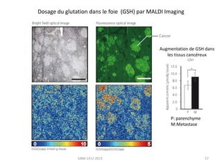 Dosage du glutation dans le foie (GSH) par MALDI Imaging

Augmentation de GSH dans
les tissus cancéreux

P: parenchyme
M:Metastase

SJBM 1412 2013

57

 