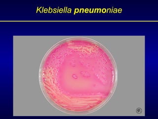Klebsiella  pneumo niae 